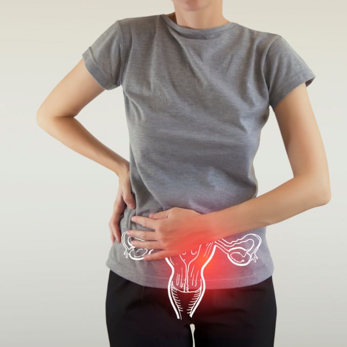 Shutterstock image ovarian cancer